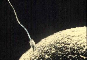 Spermienkonkurrenz – anatomische Anpassungen